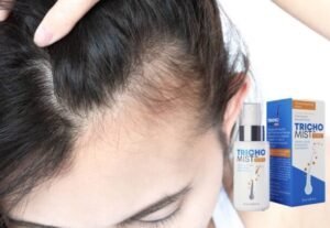 Jakie promocje oferuje Trichomist-anchor na swoje produkty? - overview